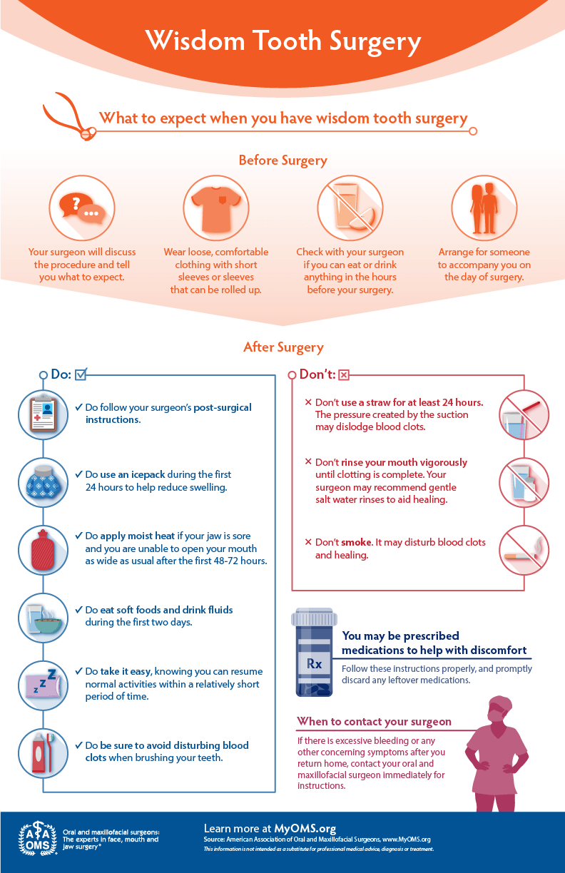 Wisdom teeth surgery at a glance — AAOMS infographic