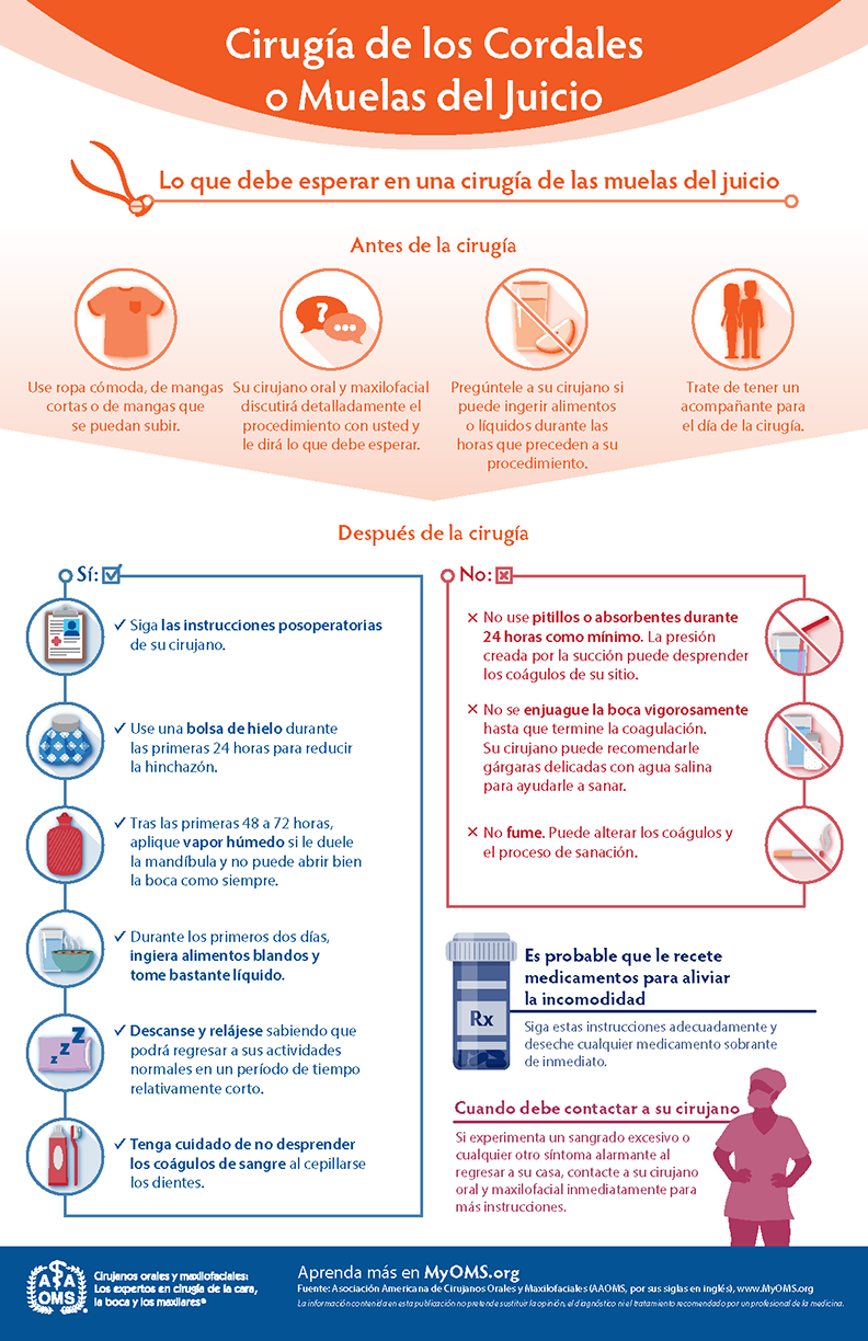 Infografía de la AAOMS: cirugía de las muelas del juicio