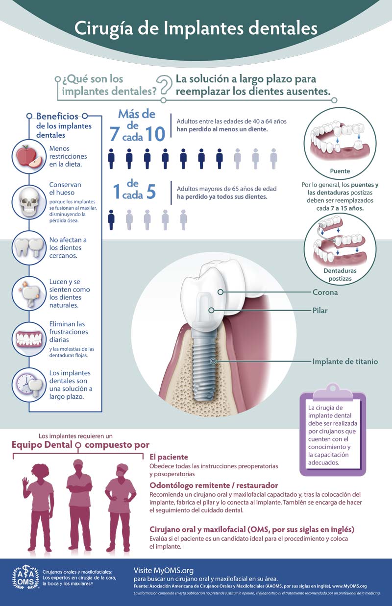 Infografía de la AAOMS: cirugía de implantes dentales