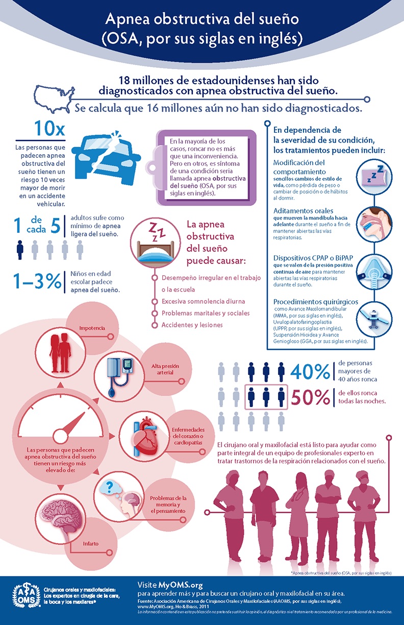 Infografía de la AAOMS: apnea obstructiva del sueño